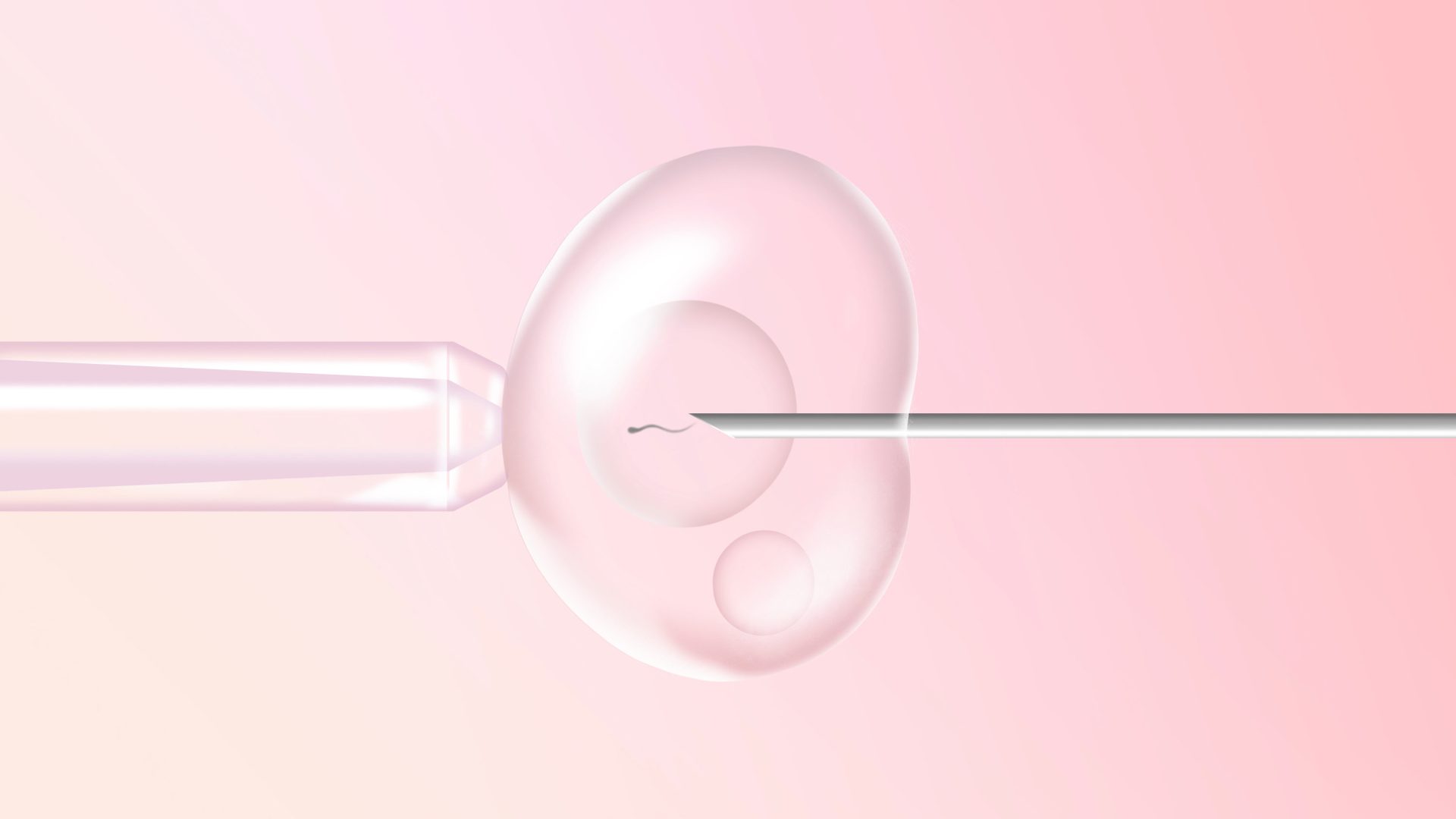 Why You Should Consider an IVF Clinic for Your Fertility Treatment