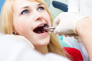 Important Things To Learn About Wisdom Tooth Extraction